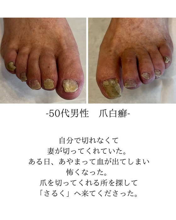 画像324